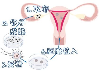 生殖中心环境